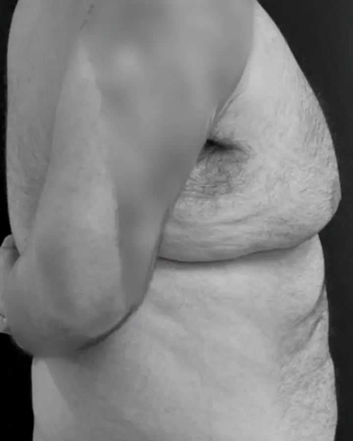Antes, caso 2 · perfil