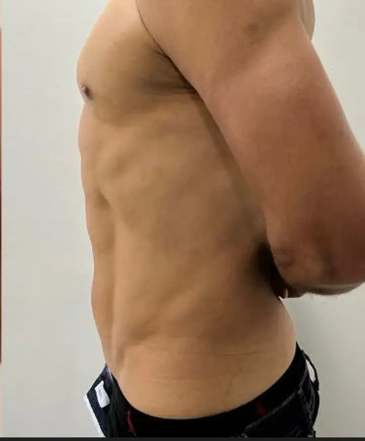 Depois, caso 15 · perfil